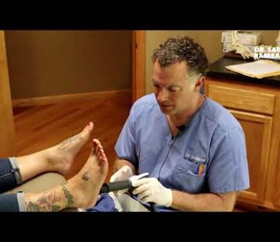 Dr. Sam Rameas - Jan 2019 Facebook Ad - Ingrown Toe Nails